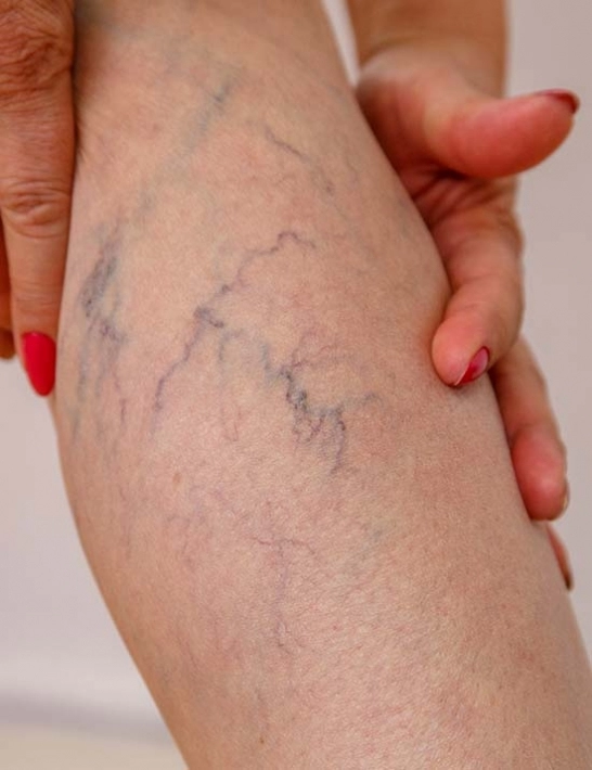 Médico-cirurgião vascular em Marília